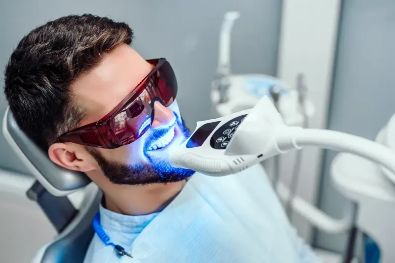 How Long Does Teeth Whitening Last?