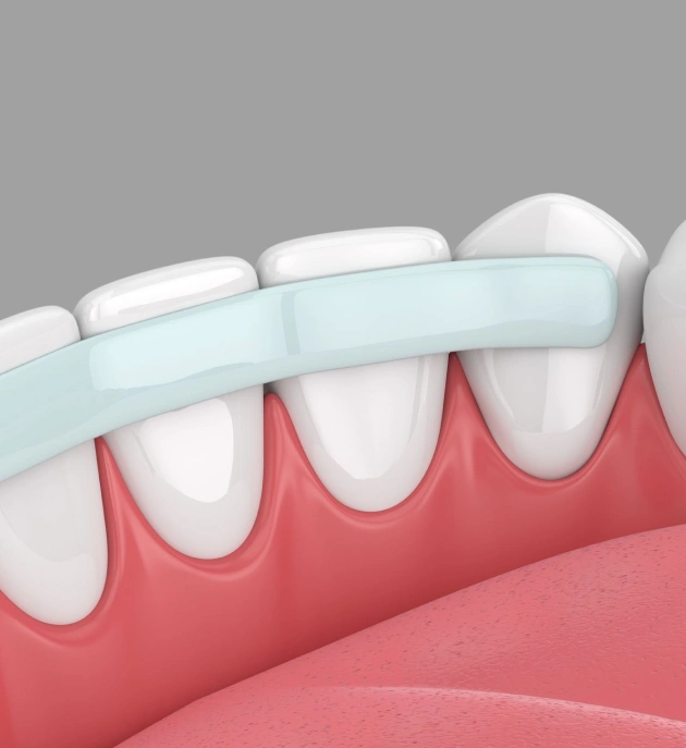Transform Your Smile With Dental Bonding
