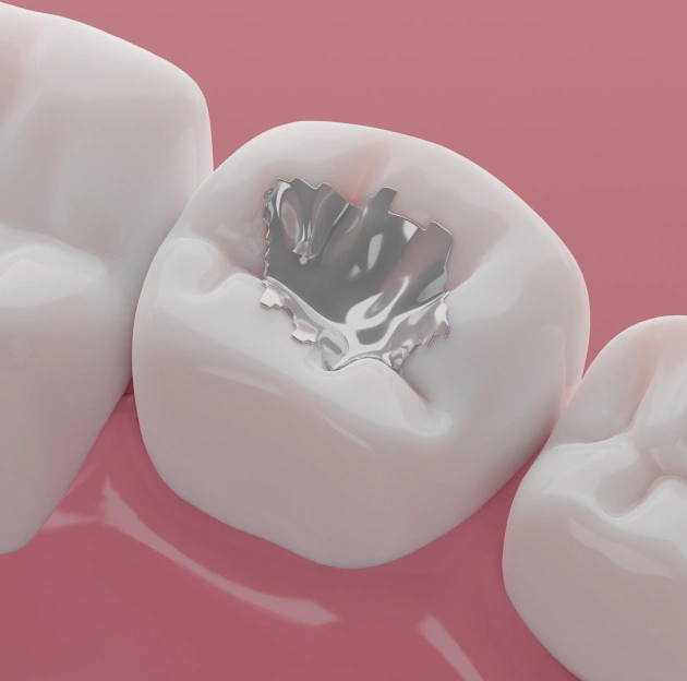 Restore Teeth and Stop Cavities Early