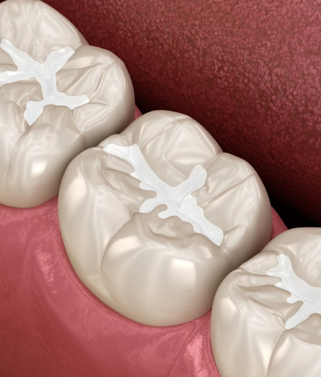 Extra Protection Against Cavities