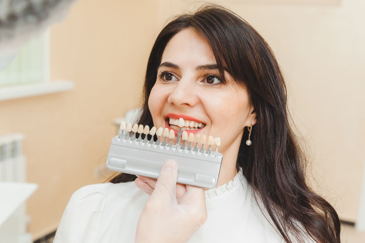 Composite Bonding Trends