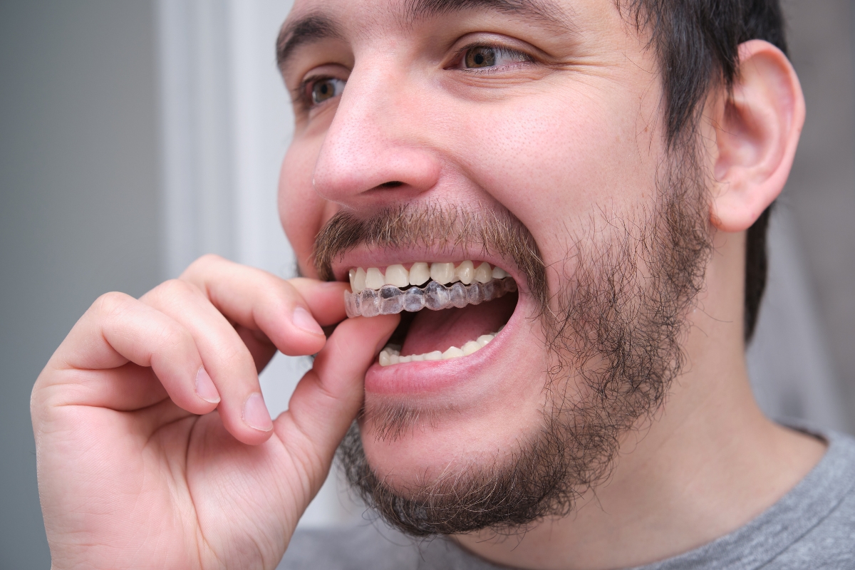 Why Clear Aligners are an Ideal Choice for Busy Professionals in Holland, PA
