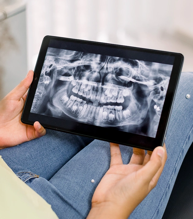 Preventive Dentistry in Holland